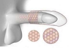 In Volumen sicherstellen